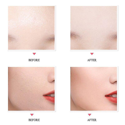 Loralix® | Ultra coverage