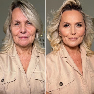 Loralix® | Ultra coverage